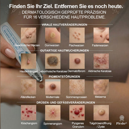 🥑7-𝐓𝒂𝒈𝒆 𝐇𝒂𝒖𝒕𝒂𝒏𝒉ä𝒏𝒈𝒔𝒆𝒍- & 𝐅𝒍𝒆𝒄𝒌𝒆𝒏𝒆𝒏𝒕𝒇𝒆𝒓𝒏𝒆𝒓